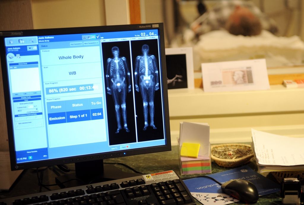 Onkoloģiskās slimības Latvijā bieži vien atklāj par vēlu