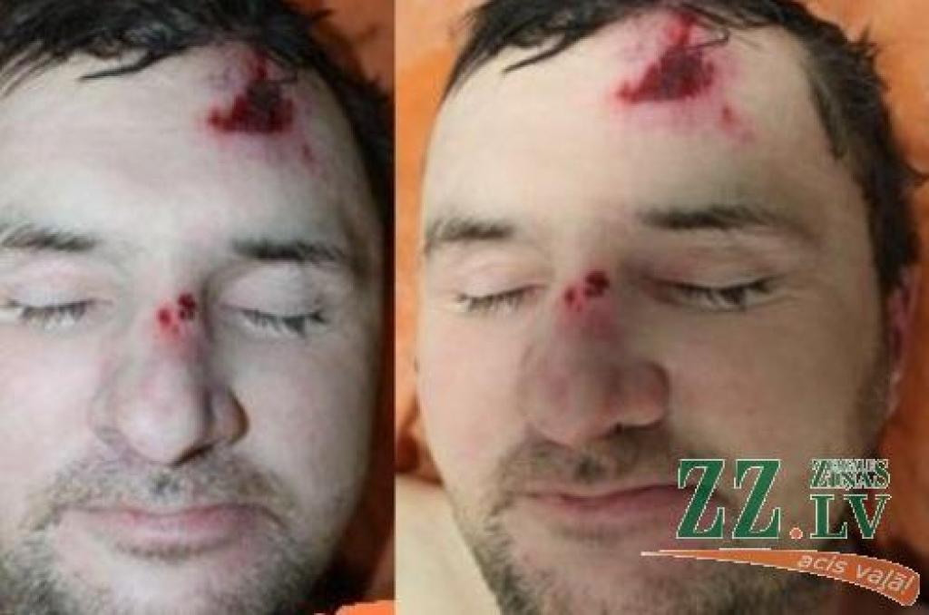 Policija lūdz atpazīt Garozas ielā mirušu vīrieti (foto)