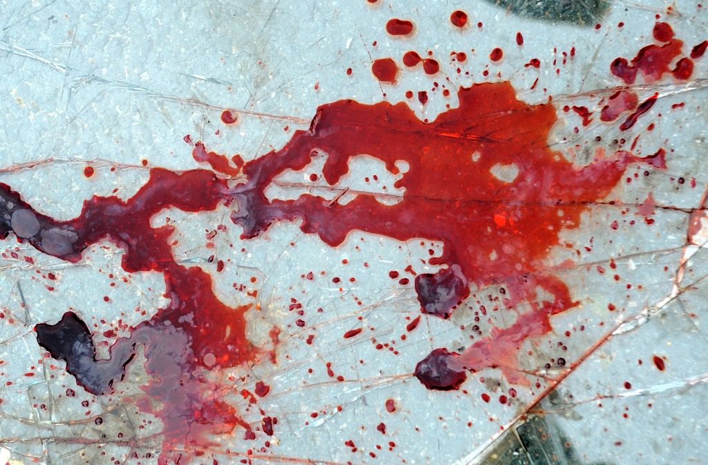 LRTV: Rēzeknes uzņēmēja nāves apstākļi liecina par pasūtījuma slepkavību