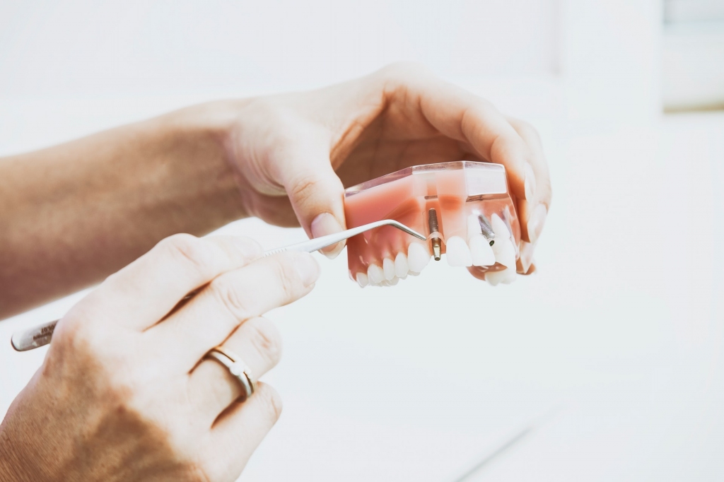 Vai ir iespējami riski zobu implanta ievietošanas brīdī?